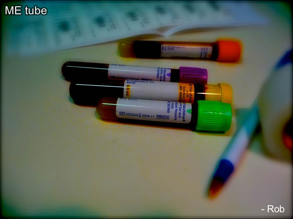 Vials of blood for testing